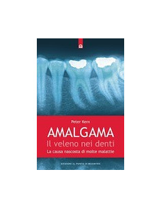 Amalgama: il Veleno nei Denti